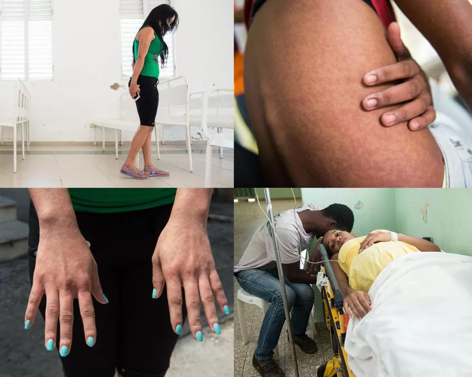 AFECTADOS. Las imágenes difundidas por la OMS muestran personas con sarpullidos y encorvadas de dolor. flickr / oms
