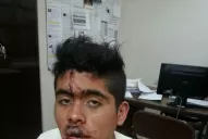 Investigan una supuesta golpiza de policías