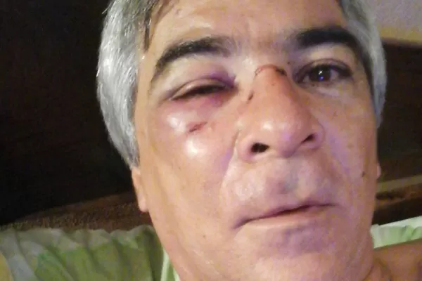 Un árbitro tucumano recibió una trompada en la cara, en pleno partido