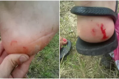 Una joven asegura que fue mordida por peces en El Cadillal