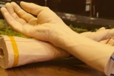 Google trabaja en una piel humana sintética para luchar contra el cáncer