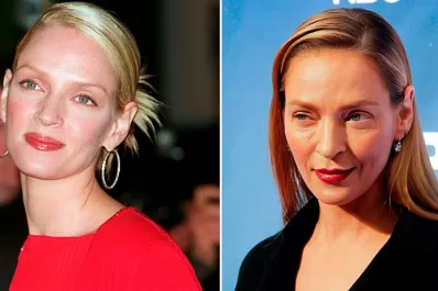 ¿Qué le pasó en la cara a Uma Thurman?
