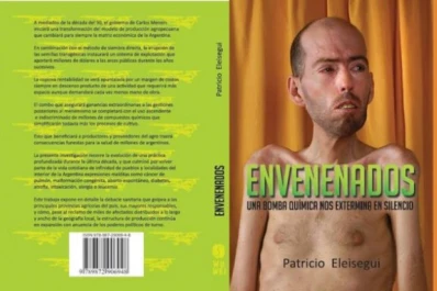 La cara más dolorosa del modelo agrícola de Argentina