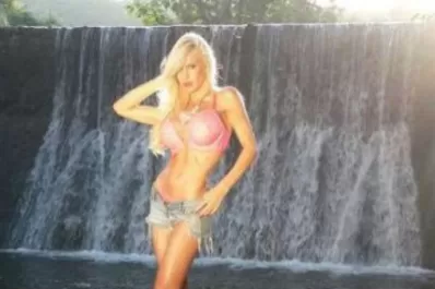 Luciana Salazar habría sufrido una mala aplicación de botox