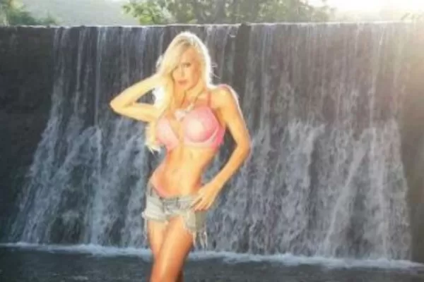 Luciana Salazar habría sufrido una mala aplicación de botox