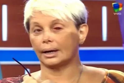 Carmen Barbieri se mostró en televisión con un “ojo explotado”