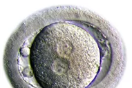 Desafiar el reloj biológico  tiene sus riesgos