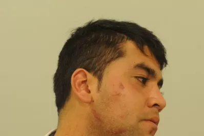 “Cuando vi los caballos, parecía una escena de Robocop”