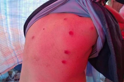 Reprimieron una marcha anti minera en Famatina e hirieron a un diputado radical