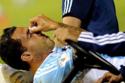 Mirá cómo será la máscara que Tevez utilizará ante Racing