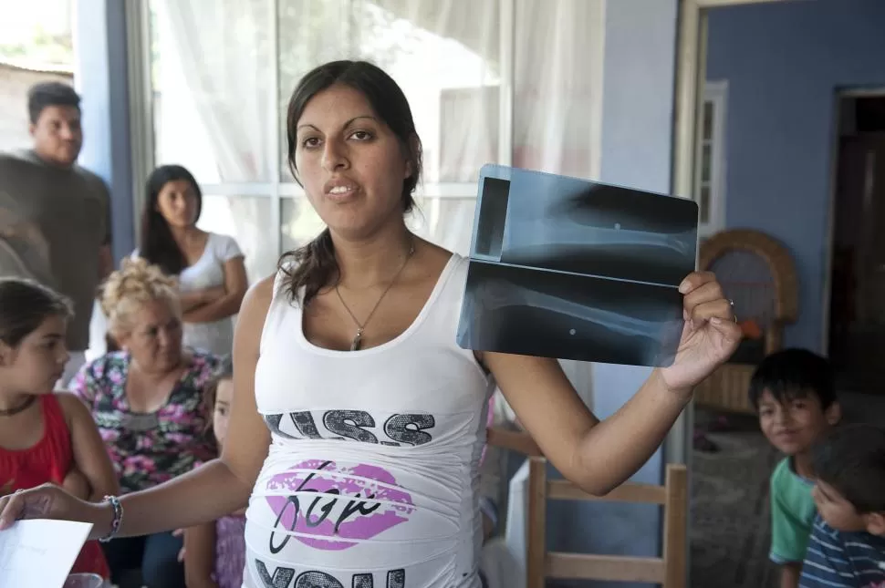 SECUELA. La madre del niño muestra la radiografía donde se observa el balín alojado en el brazo del pequeño. la gaceta / fotos de florencia zurita