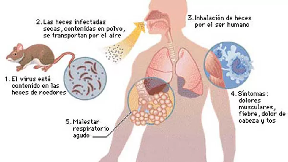 ¿Qué es, cómo se transmite y cómo se detecta el hantavirus?