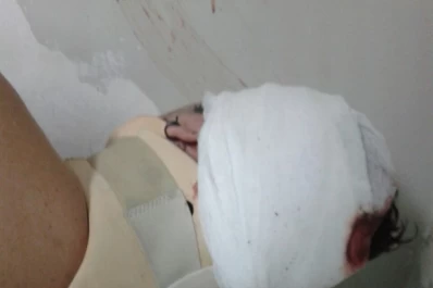 Desde el hospital, el acompañante de la mujer que robó un auto y lo chocó se despegó de los ilícitos