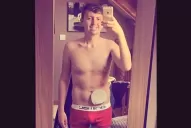 Con una selfie mostró cómo vive con su colostomía y se hizo viral