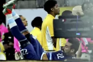 ¡Tremendo! Así le quedó el brazo a Lavezzi tras su caída