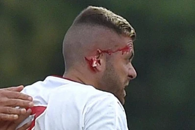 Un futbolista perdió parte de su oreja por una dura falta