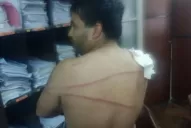 Una fiesta terminó con tiros, heridos y detenidos