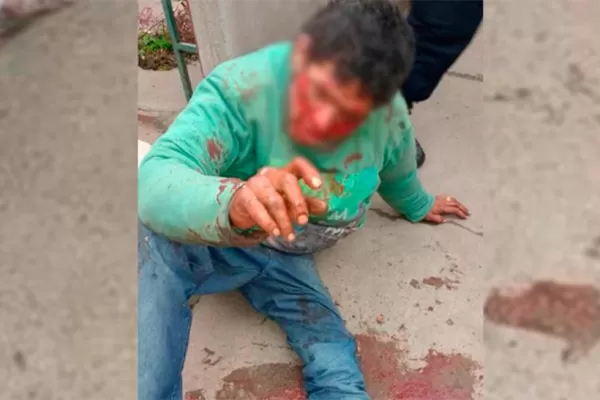 Video: lo desfiguraron a golpes porque habría intentado robar un televisor