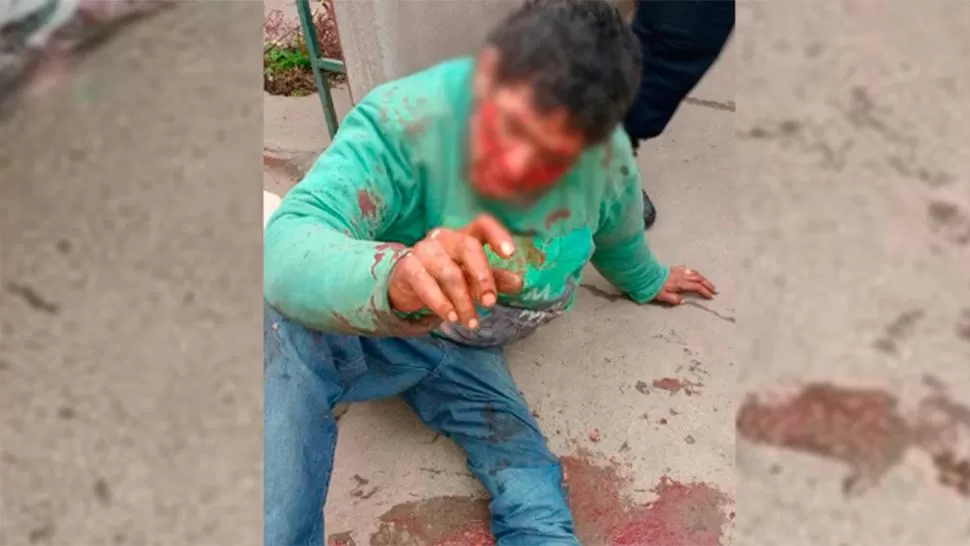 EN EL SUELO. La Policía encontró al sospechoso ensangrentado, rodeado de vecinos. 