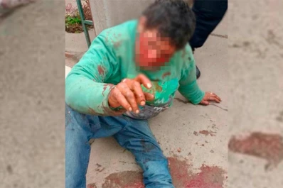 Lo desfiguraron por asaltar y golpear a una mujer