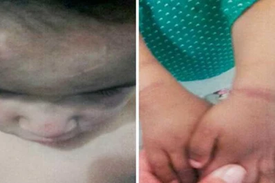 Detienen a un matrimonio por torturar y quemar a sus hijos con cigarrillos