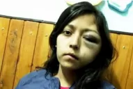 Detuvieron a un soldado en Mendoza por desfigurar a golpes a su ex pareja