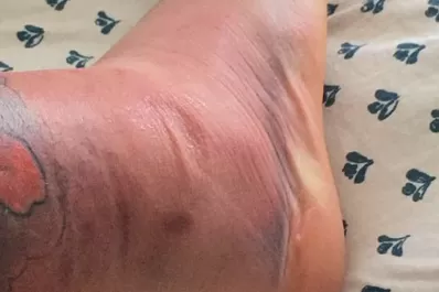 Así le quedó el tobillo a Rossi, el pibe que debutó como titular en River