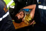 Uno de los sobrevivientes de Chapecoense no recuerda el accidente y preguntó cómo salió el partido