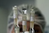 Zika: ya son tres los casos de microcefalia