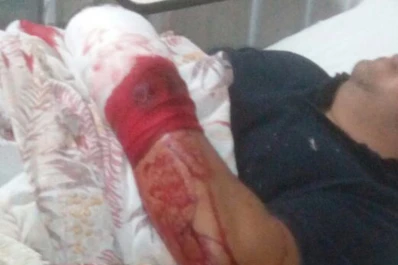 Un policía sufrió serias heridas al tratar de repeler una muchedumbre exaltada en Burruyacu