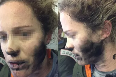 Le explotaron los auriculares en pleno vuelo