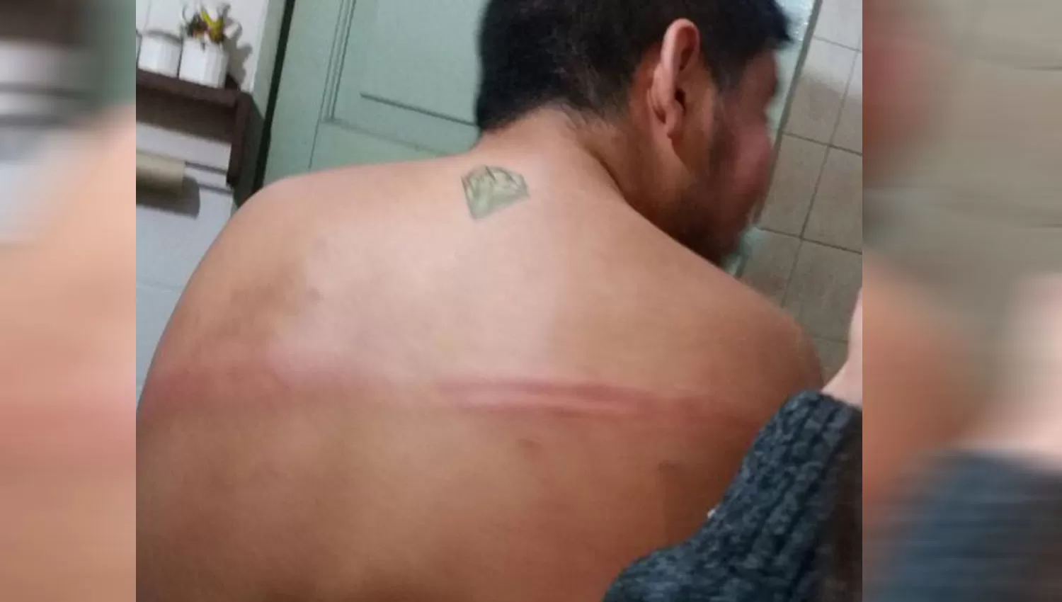 GOLPES. Uno de los denunciantes muestra las lesiones. FOTO ENVIADA POR WHATSAPP