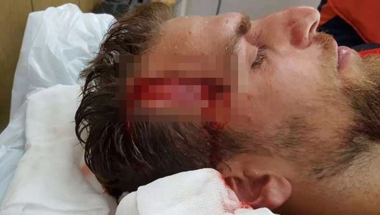 IMPRESIONANTE CORTE. Así terminó Francisco Vazzoler. (FOTO TOMADA DE TWITTER)