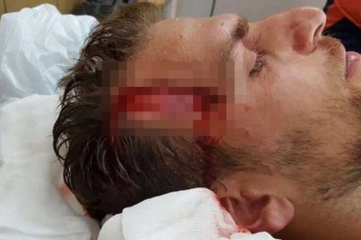 Mirá el impresionante corte que sufrió un futbolista de la B Metropolitana