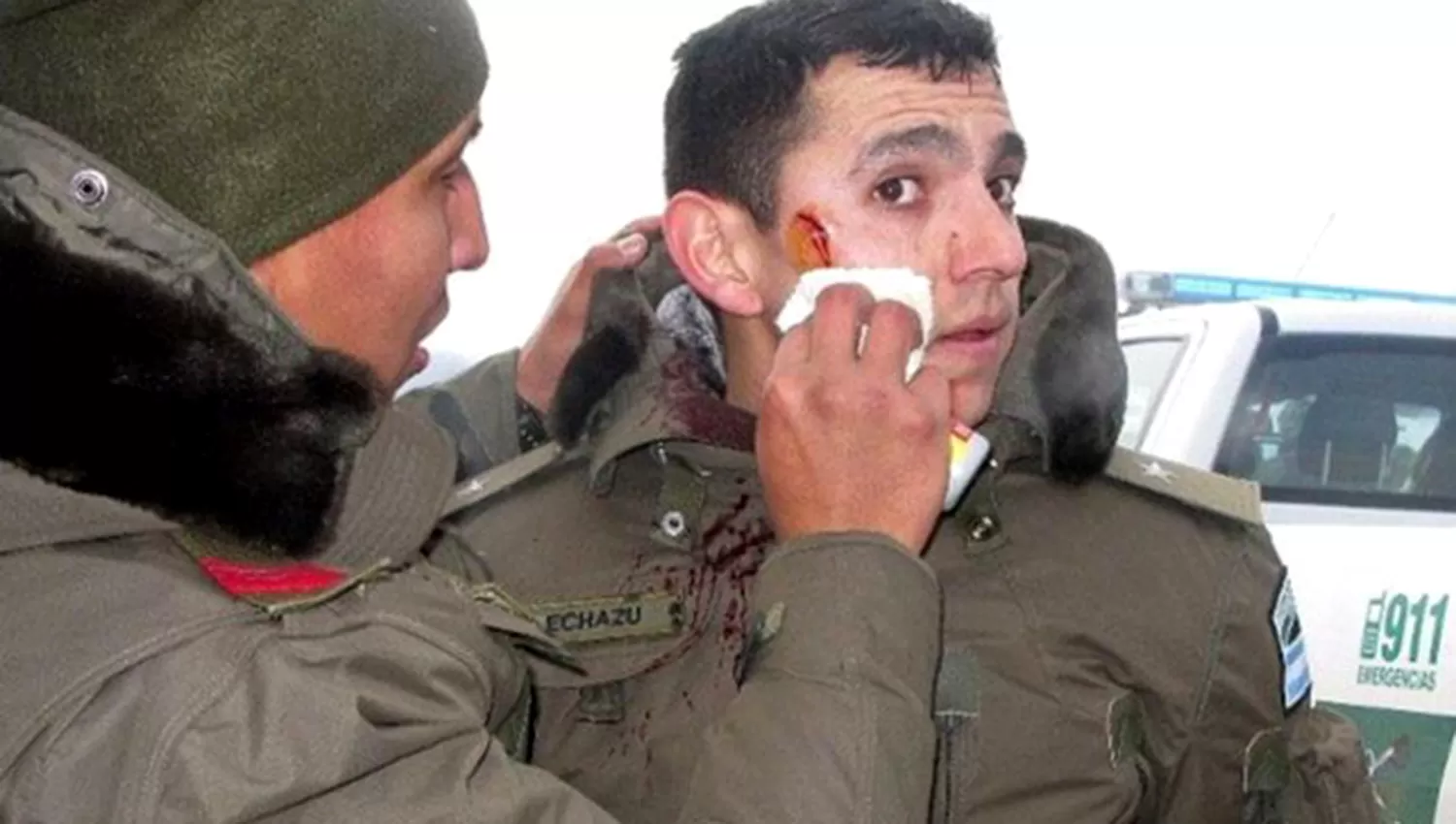 ECHAZÚ. El gendarme con la cara lastimada de 1 de agosto. FOTO TOMADA DE LA CAPITAL