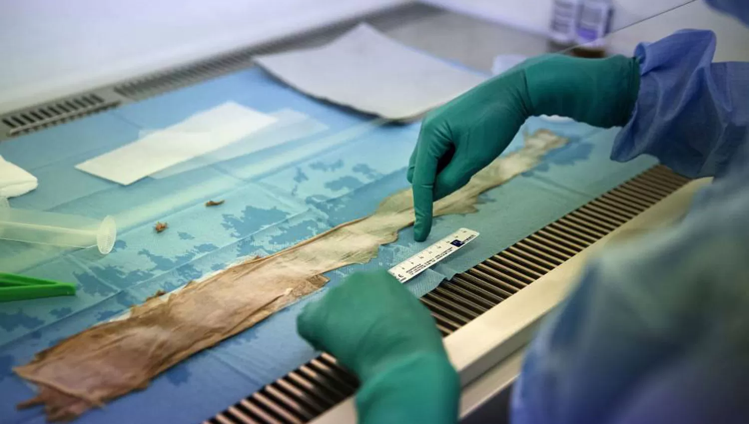 DESAFÍO CIENTÍFICO. A partir de cuatro centímetros de piel lograron multiplicar las células y obtener un metro. FOTO TOMADA DE ELPAIS.COM