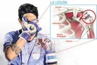 Lucchetti será operado hoy en Buenos Aires y ya planea su regreso para 2018