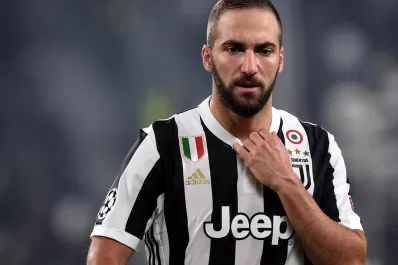 Higuaín fue operado de la mano izquierda y será baja ante el Napoli