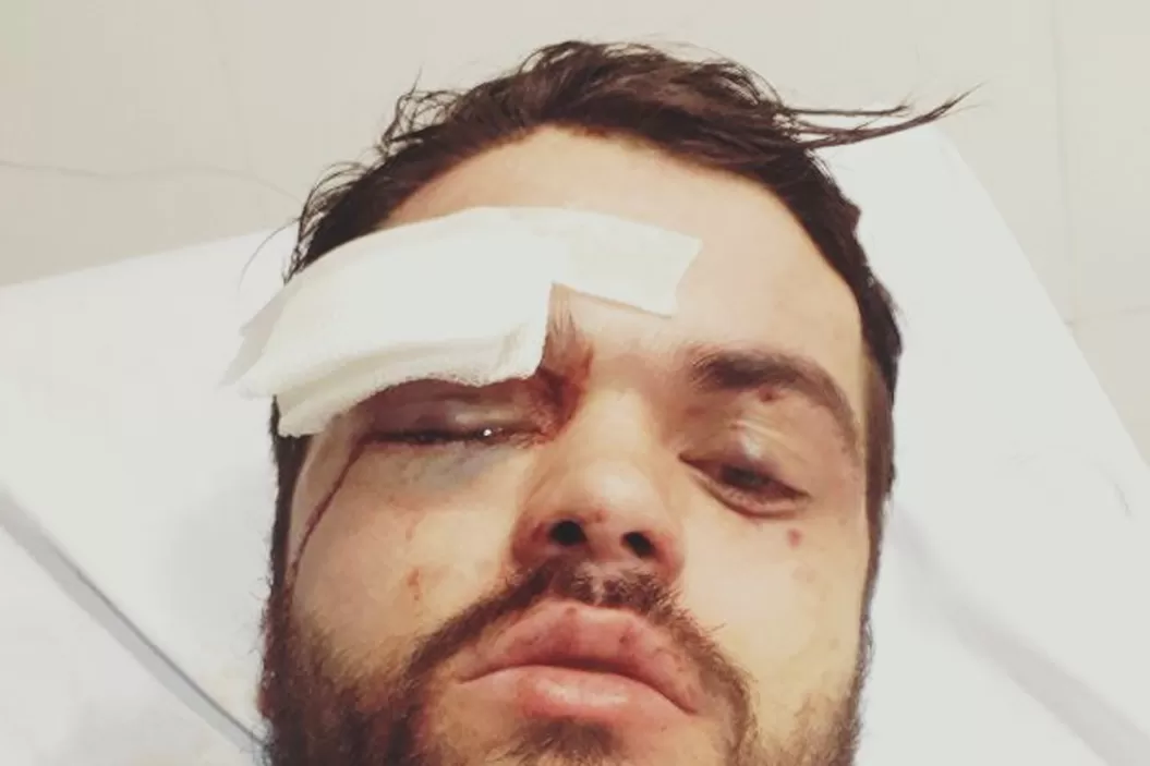 HOMOFOBIA. Jonathan Castellari. FOTO TOMADA DE CIERVOS PAMPA RUGBY.