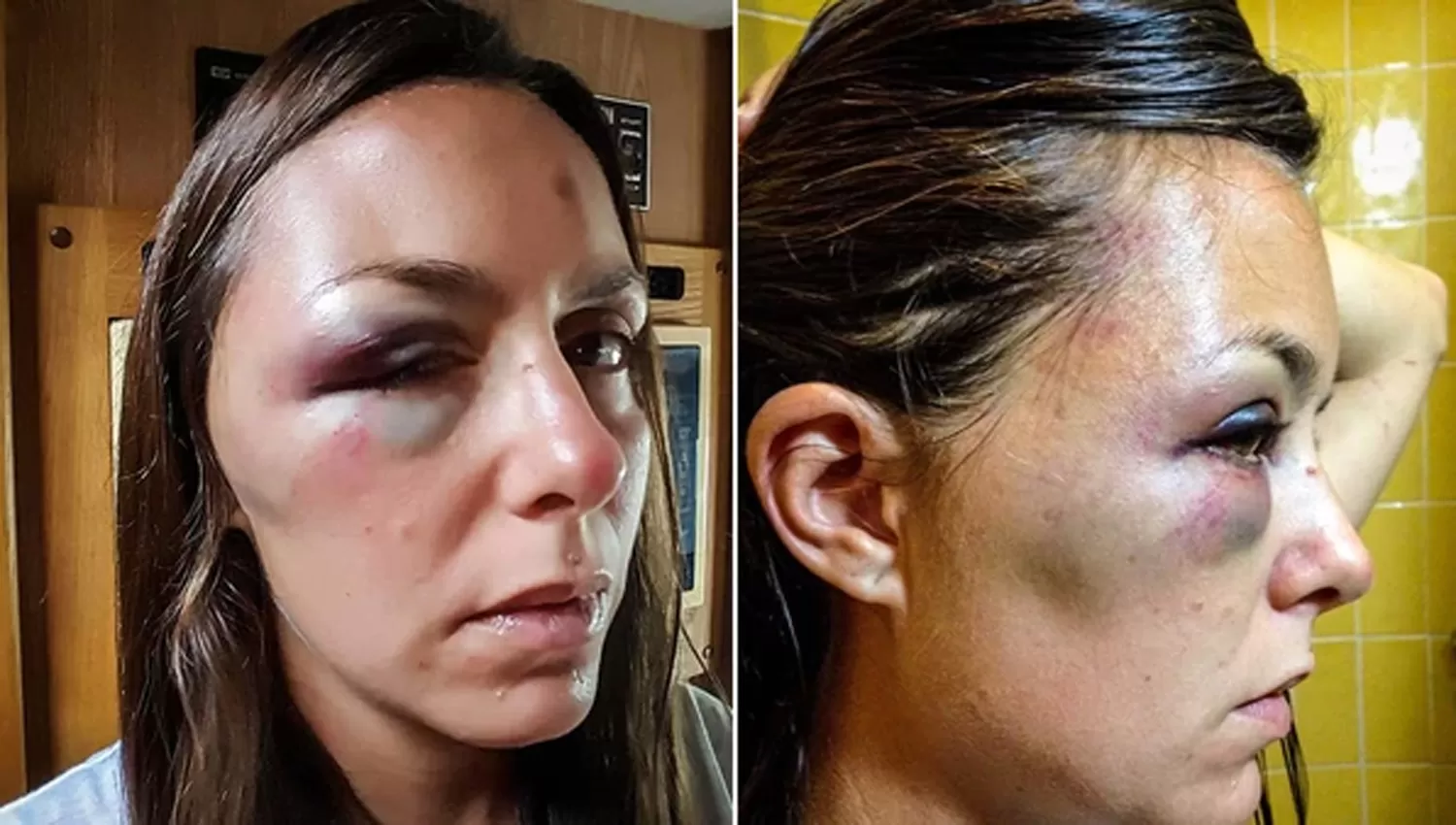 ANDREA CARENZO. Así quedó la víctima. FOTO TOMADA DE INFOBAE.COM