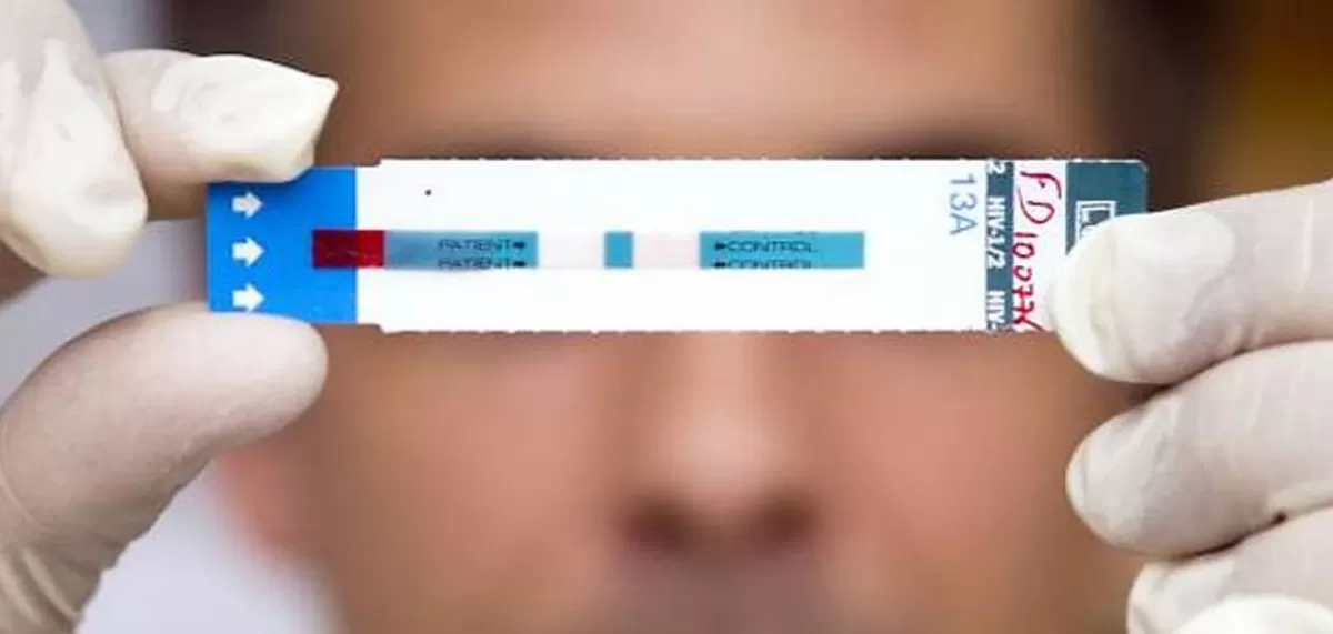 Hoy, testeo rápido de VIH en el parque Avellaneda