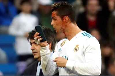 Video: la insólita reacción de Cristiano Ronaldo al verse el rostro ensangrentado y los siete goles del Real Madrid