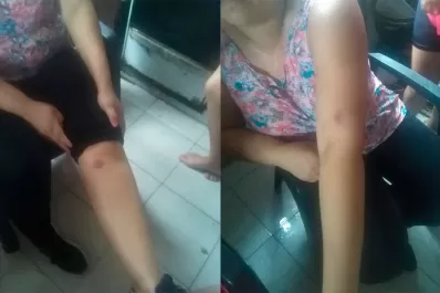 Video: los afectados por los gestores de casas denunciaron que fueron reprimidos por la Policía