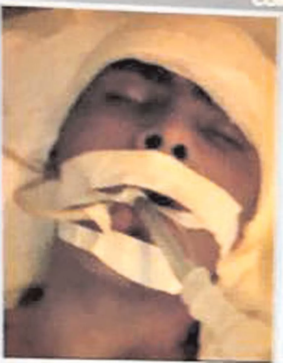 LA VICTIMA. El joven está internado en grave estado. 