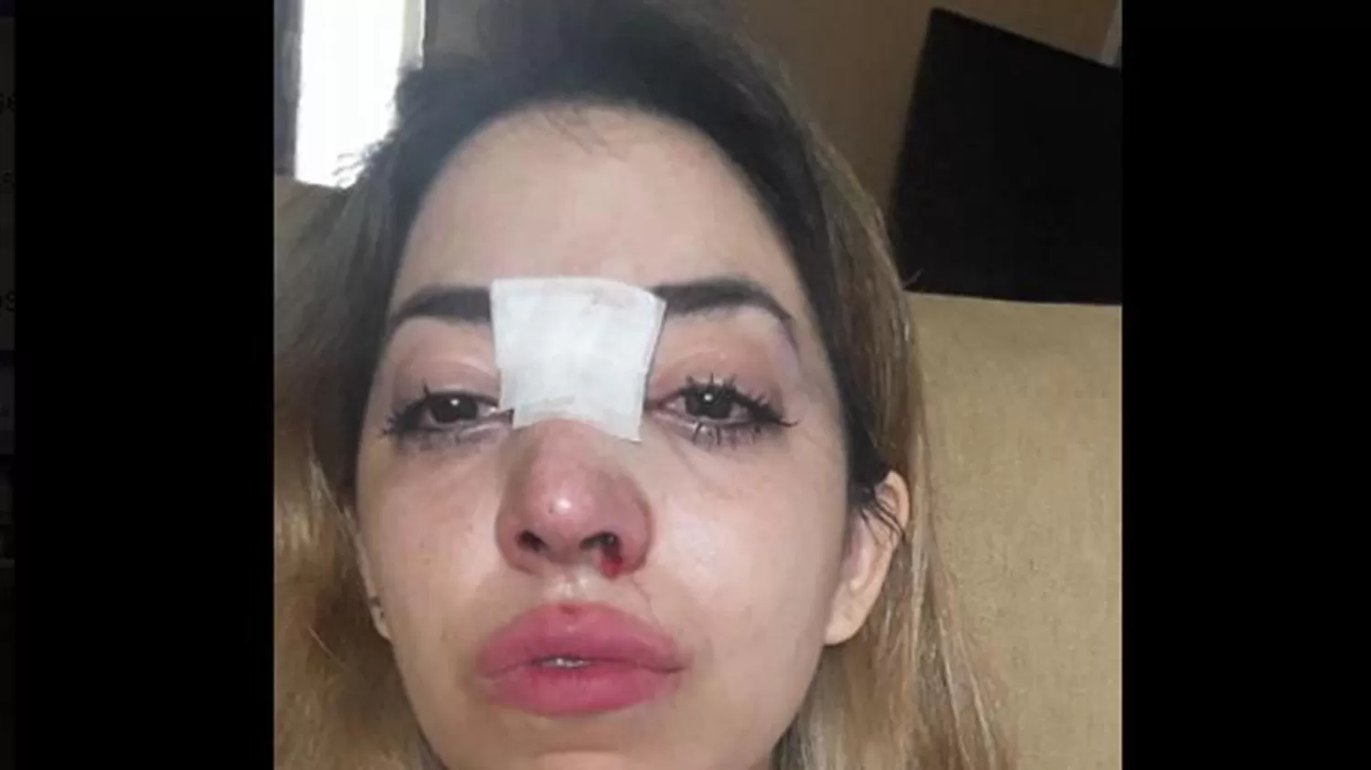 VIOLENCIA. Natalia Silva luego de la golpiza. FOTO TOMADA DE LA CUENTA DE FACEBOOK DE LA VÍCTIMA.