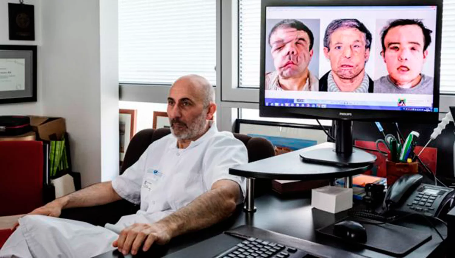 EL HOMBRE DE LAS TRES CARAS. El francés perdió su cara por segunda vez a causa de un resfrío. FOTO TOMADA DE LA BBC