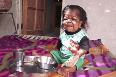 La increíble historia del hombre que está atrapado en el cuerpo de un bebé