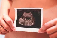 Cómo son las posturas de países de América respecto al aborto: dónde es legal