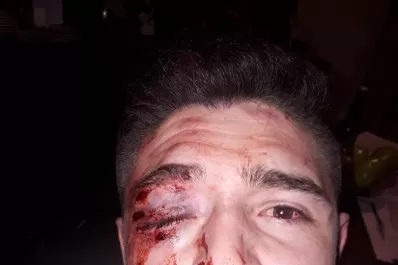 Un joven acusa a patovicas y policías por un brutal ataque en un boliche