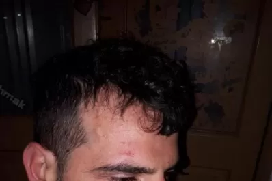 Confirman las lesiones de un joven que denunció a guardias